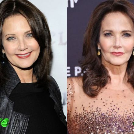 Lynda Carter Before And After Plastic Surgery Plastic Surgery Mistakes