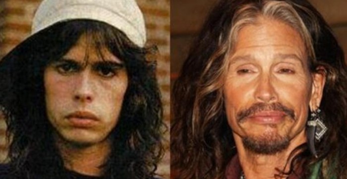 Steven Tyler plastic surgery - has the rocker gone too far?