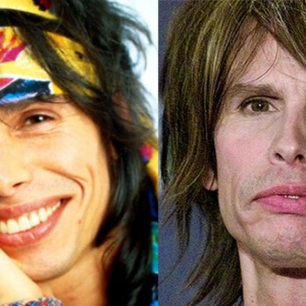 Steven Tyler plastic surgery - has the rocker gone too far?