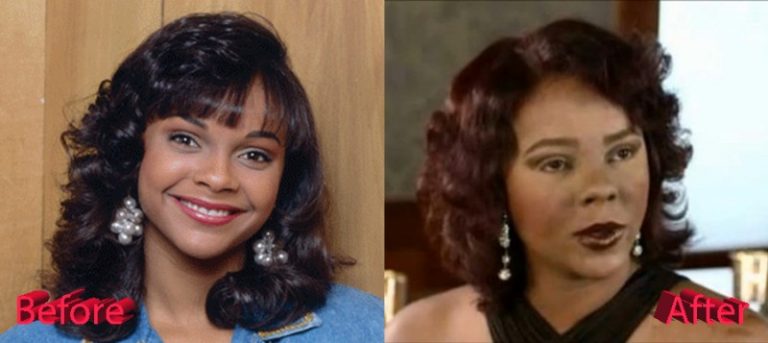 Lark Voorhies Plastic Surgery Gone Wrong - Plastic Surgery Mistakes