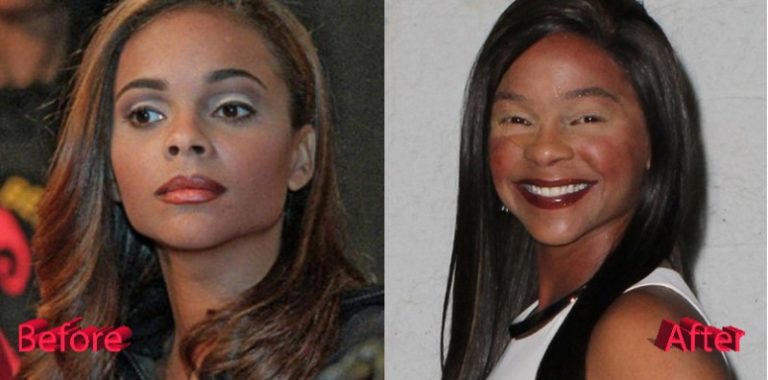 Is It Likely that Lark Voorhies Has Had Plastic Surgery?