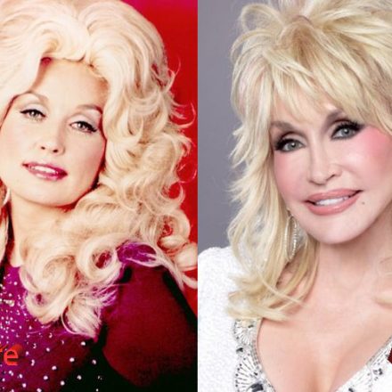 Dolly Parton Before And After Facelift - Plastic Surgery Mistakes