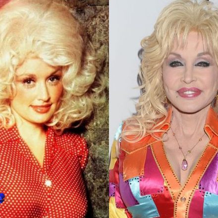 Dolly Parton Before and After Plastic Surgery - Plastic Surgery Mistakes