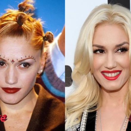 Gwen Stefani Before and After Facelift - Plastic Surgery Mistakes