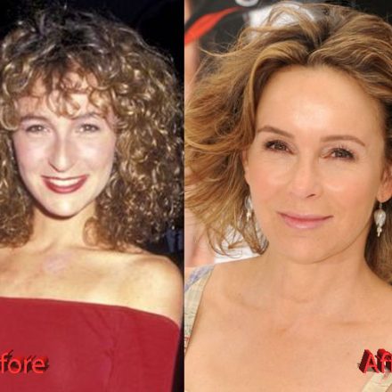 How Jennifer Grey's Nose Job almost ruined her career - Plastic Surgery ...