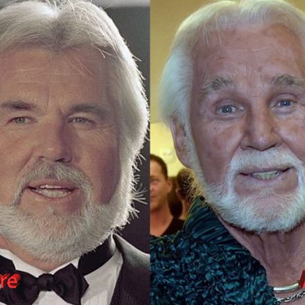 Kenny Rogers Plastic Surgery : An Obsession with it? - Plastic Surgery ...