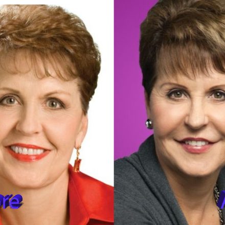 Joyce Meyer Plastic Surgery Before And After Plastic Surgery Mistakes