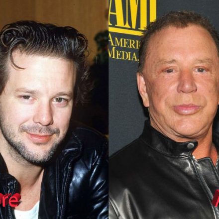 Mickey Rourke Plastic Surgery2 - Plastic Surgery Mistakes