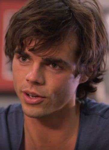 Reid Ewing Plastic Surgery A Health Hazard Plastic Surgery Mistakes