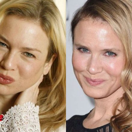 Renee Zellweger Plastic Surgery: A Big Mistake - Plastic Surgery Mistakes