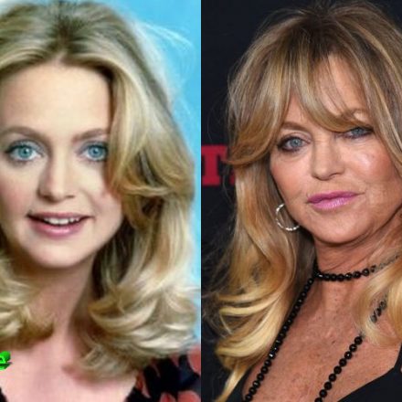 Goldie Hawn Before and After Facelift - Plastic Surgery Mistakes
