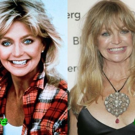 Goldie Hawn Plastic Surgery Controversy - Plastic Surgery Mistakes