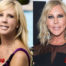 Vicki Gunvalson Plastic Surgery: Where Is The End Of It?