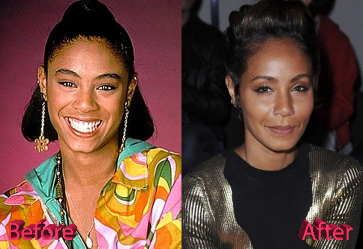 Jada Pinkett Smith Plastic Surgery: A Bad Decision