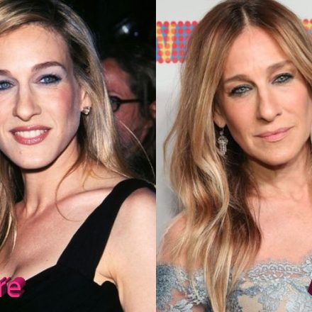 Sarah Jessica Parker Plastic Surgery: Very Visible Changes