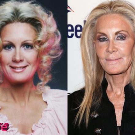 Joan Van Ark Plastic Surgery When Everything Goes Wrong