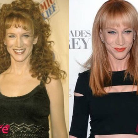 Kathy Griffin Plastic Surgery Procedures: Win Or Fail?