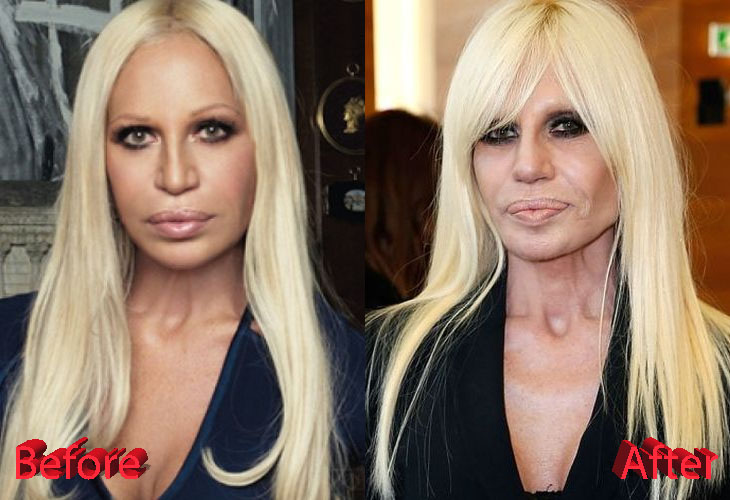 Woman and Time: #Donatella #Versace. Before and After 
