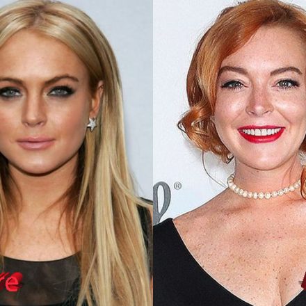 Lindsay Lohan Plastic Surgery : Is She Done With It?