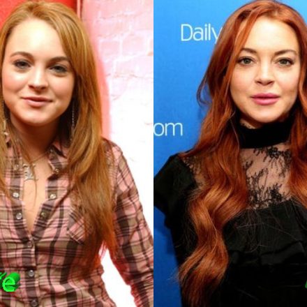 lindsay lohan plastic surgery before and after