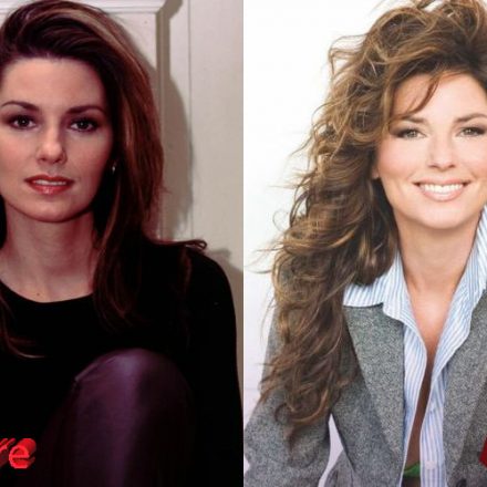 Shania Twain Plastic Surgery Before And After Telegraph