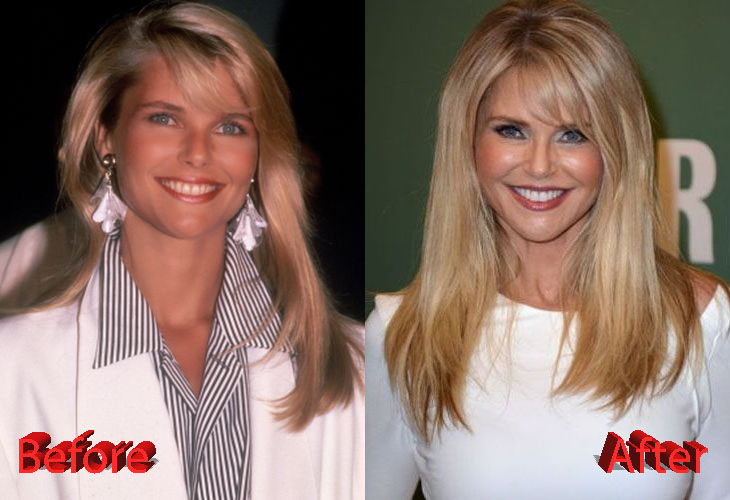 Christie Brinkley Plastic Surgery : The Lovely Fashion ...