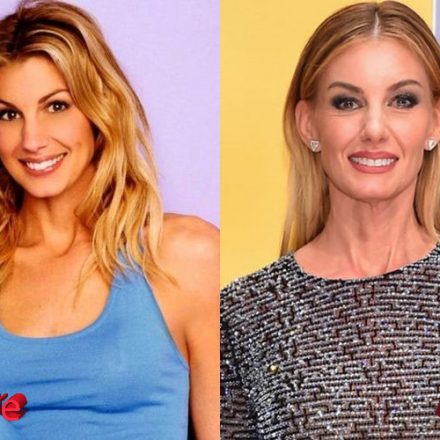 Faith Hill Before and After Plastic Surgery - Plastic Surgery Mistakes