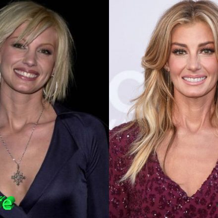 Faith Hill Plastic Surgery: A Youthful Look For A Country Star