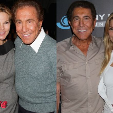 Andrea and Steve Wynn Plastic Surgery: Not the Best of Ideas