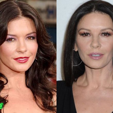 Catherine Zeta Jones Plastic Surgery: New Look For The Comeback