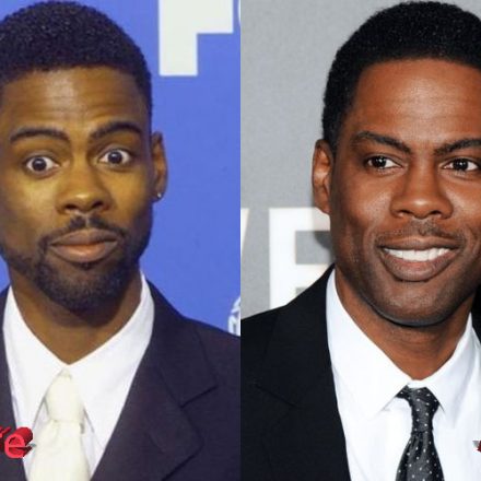 Chris Rock Plastic Surgery: A Real Improvement For Chris