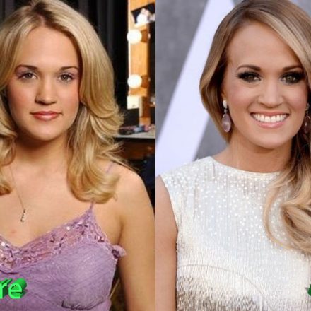 Carrie Underwood Plastic Surgery: Looking Better Than Ever