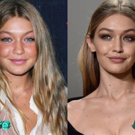 Gigi Hadid Plastic Surgery: Looking Better Than Ever