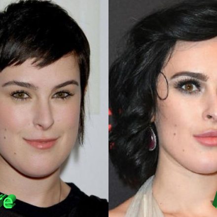 Rumer Willis Plastic Surgery: Was It A Change For the Better?