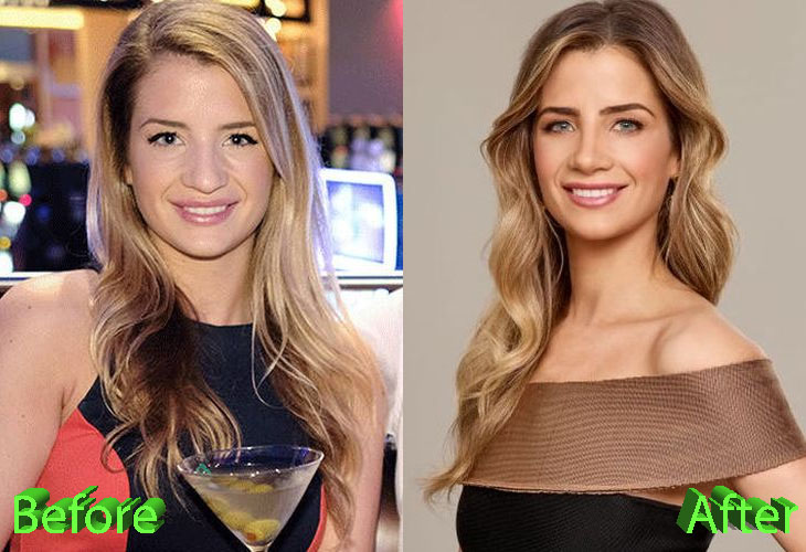 Naomie Olindo Nose Job: A Good Change In Appearance