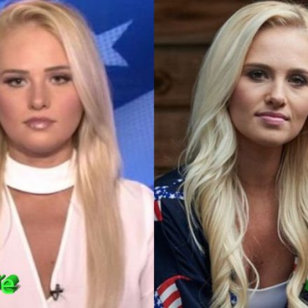 Tomi Lahren Plastic Surgery: Making Headlines For Her Face