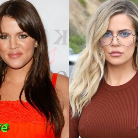 The History of Khloe Kardashian Plastic Surgery Procedures